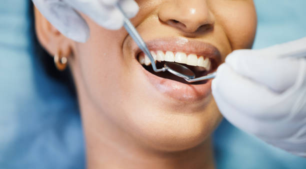Best Emergency Root Canal Treatment in South Gate Ridge, FL
